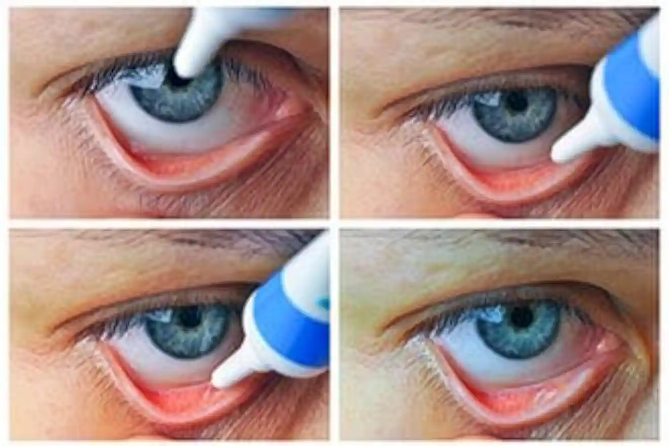Patient Using Eye Ointment