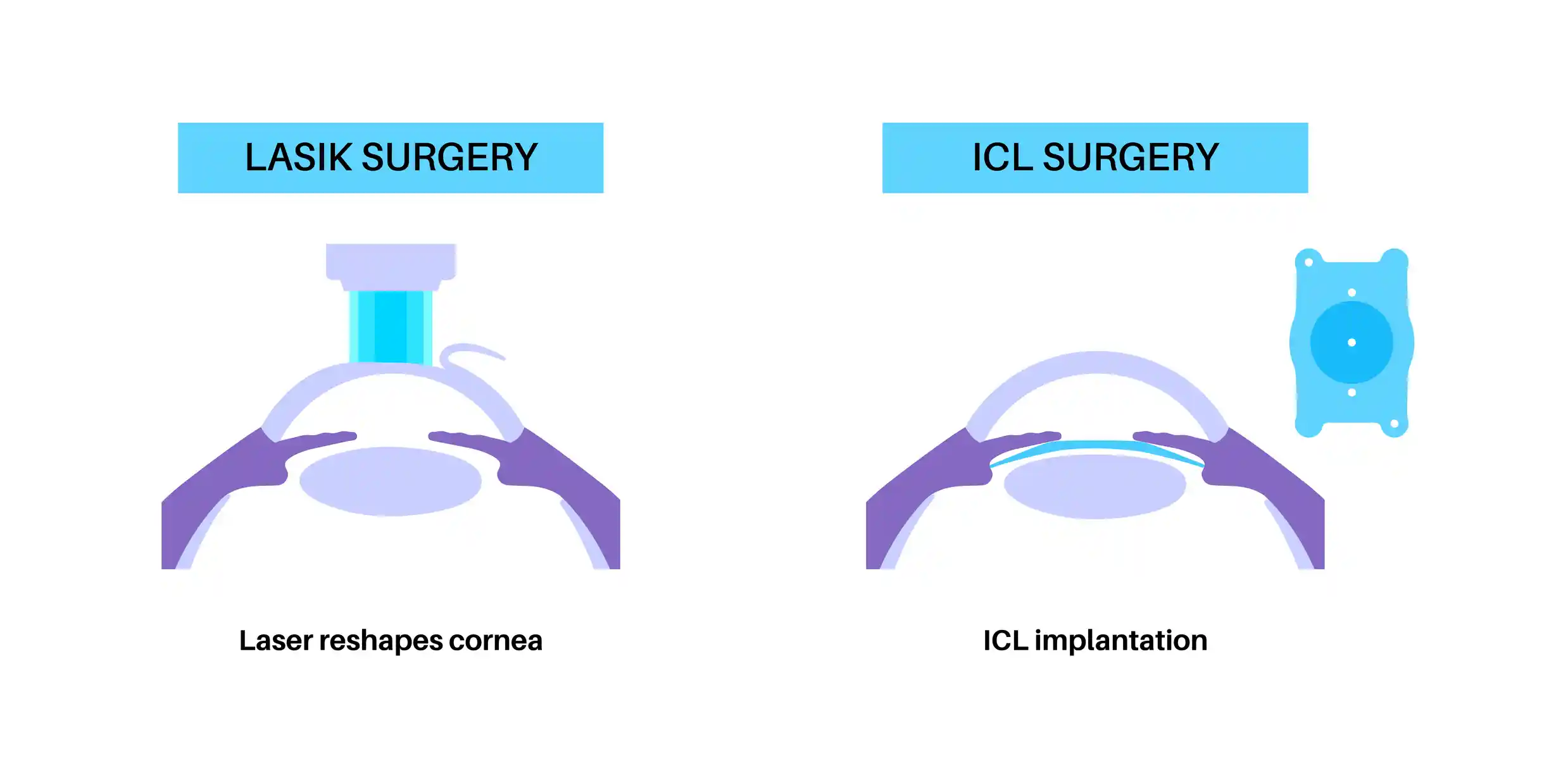 Eye Surgeon Explaining ICL vs LASIK