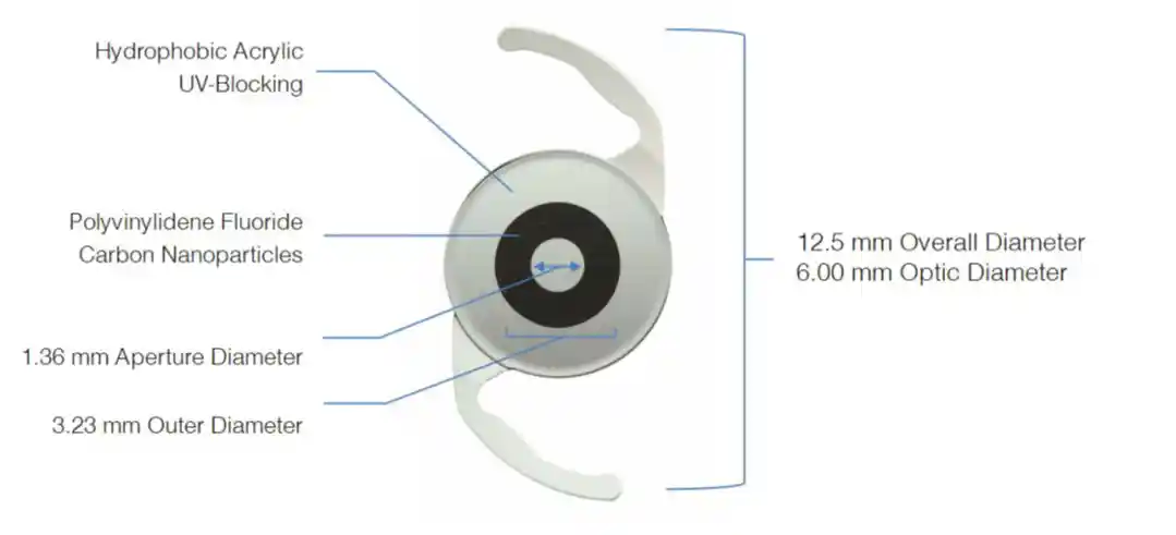 Intraocular Lens Implant Diagram
