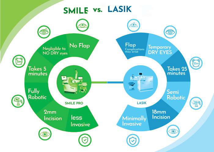SMILE Vs LASIK